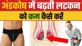 अंडकोष के लटकने के कारण  Hanging testicles Treatment at Home  Varicocele Treatment  Dr Health [upl. by Dosia398]