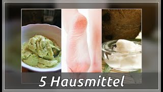 5 Hausmittel gegen gerissene Fersen [upl. by Nodyroc17]