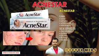 AcneStar ll Acne l Pimples l Whiteheads l Blackheads ll Doctor Meds ll Uses In Hindi amp English Sub [upl. by Skelly]