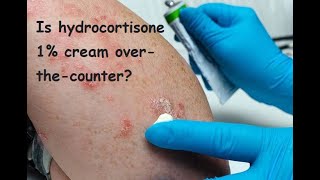 Is hydrocortisone 1 cream over the counter [upl. by Analihp63]