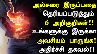 அல்சர் வருவதற்கான 10 அறிகுறிகள்  Stomach Ulcer Symptoms in Tamil Tamil Health tips [upl. by Okika924]