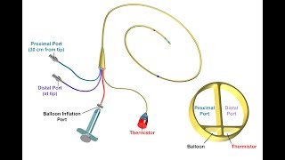 Proper Insertion and Use of a Pulmonary Artery Catheter  BAVLS [upl. by Tiras]