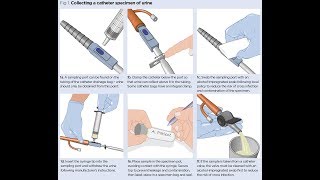 Catheter Urine Sample Collection Video for NMC OSCE Part 2 Exam [upl. by Legir]