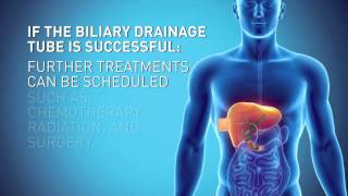 Biliary Drain [upl. by Leummas443]