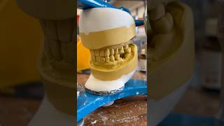 mounting dentatus Articulator ￼facebow [upl. by Ainesey]