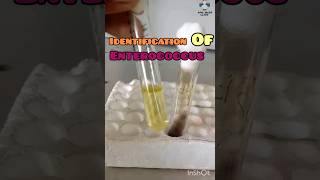 Identify Enterococcus Fecalis  Bile Esculin Agar  Catalase Test  GPC bacteriology microbiology [upl. by Ydoow564]