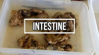 Intestines  small and large gross anatomy [upl. by Mateusz987]