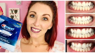 Crest 3D White One Hour Express Whitestrips CREST WHITENING BEFORE AND AFTER REVIEW [upl. by Geri]