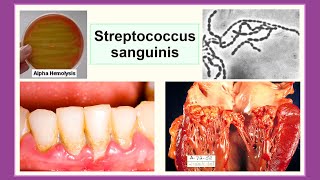 Streptococcus sanguinis [upl. by Idac]