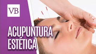 Acupuntura estética  Você Bonita 301018 [upl. by Zenger123]