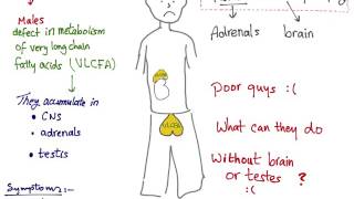 Adrenoleukodystrophy ALD mnemonic [upl. by Pomcroy]