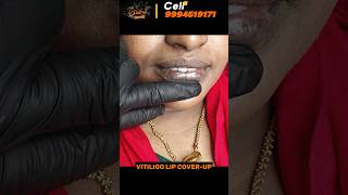 Vitiligo lips vitiligo treatment in trichy best method vitiligo treatment best tattoo studio [upl. by Neelhsa]