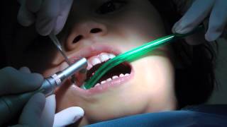 1st Dentist Visit after Drill amp Filling Kid Loves Singing Dentist [upl. by Burget776]