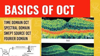 WHAT IS OCT  OCT technology explained [upl. by Ahsenat]