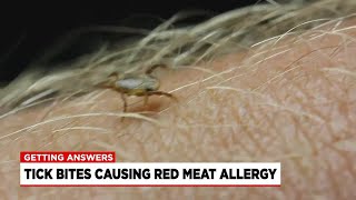 Doctors seeing increase in cases of meat allergy tied to some ticks [upl. by Anilehcim732]