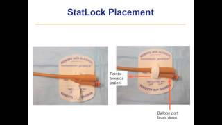 Catheterization Troubleshooting [upl. by Teplica]