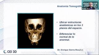 Webinar quotEvaluación de algunas anomalías dentarias con Tomografía Cone Beam quot [upl. by Nivak]