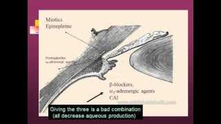 Glaucoma Drug Therapy [upl. by Gaughan366]