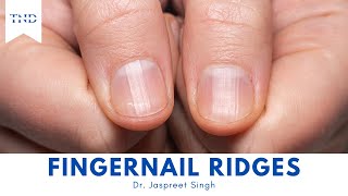 Do You Have Vertical Ridges On Your Fingernails Heres What They Mean [upl. by Shepard]