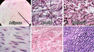 Identifying Connective Tissue  Review and Practice [upl. by Meer306]