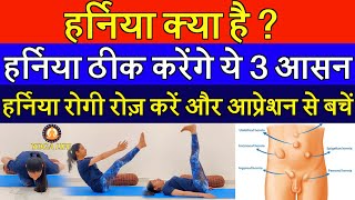 Best 3 Yogasana to Cure Hernia  What is Hernia Its Type Causes and Treatment YOGALIFELINE [upl. by Sualakcin]