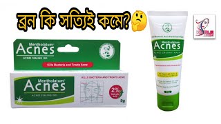 এটা কি সত্যিই ব্রন দূর করেAcnes Mentholatum Sealing GelAcne Treatment khadija begum [upl. by Vergne156]