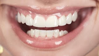 Transform Your Smile  How Can Orthodontic Treatment Improve Your Oral Health [upl. by Sibyls216]