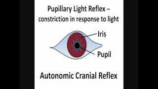 Pupillary Light Reflex  Cranial Nerves II amp III [upl. by Dimitris]