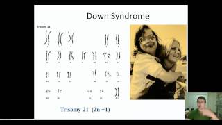 NonDisjunction Disorders [upl. by Barmen]