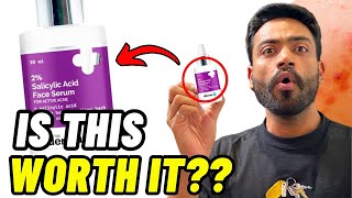 YOU WONT BELIEVE The Derma Co SALICYLIC ACID Serum HONEST REVIEW  The Derma Co  Skincare [upl. by Ahsimot]