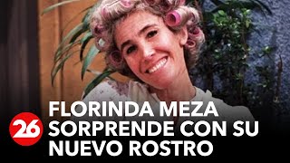 El impactante cambio en el rostro de Doña Florinda [upl. by Assyral]