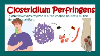 Clostridium Perfringens  Gas gangrene  What is the treatment for Clostridium perfringens [upl. by Harmon]