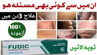 FUDIC FUDIC fusidic acid cream uses in UrduFUDIC CREAMhow to use FUDIC CREAM in Urdu [upl. by Siroled]