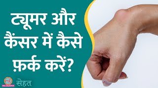 क्या Biopsy करवाने से Cancer फैल सकता है जानिए डॉ ने क्या बताया  Sehat ep 868 [upl. by Hylton716]