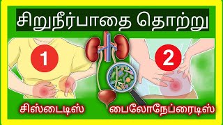 Urinary infection Tamil  cystitis pyelonephritisurine infection symptoms in TamilSTAR LABORATORY [upl. by Eilram]