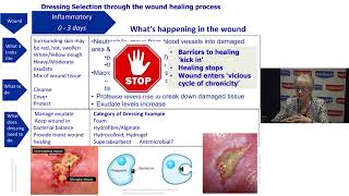 Understanding Wound Dressings Categories and Indications [upl. by Pollak]