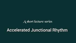 Accelerated Junctional Rhythm ECG ECG made easyAccelerated Junctional Rhythm [upl. by Adnaram]