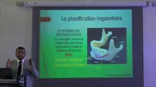 4ème commandement dentaire la planification implantaire [upl. by Rosabelle925]