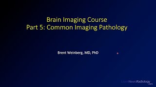 Brain imaging course – 5 – Common imaging pathology [upl. by Nnaihs580]