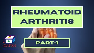 Why Rheumatoid Arthritis Develops Exploring Pathophysiology and Risk Factors [upl. by Selima463]