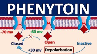 Phenytoin  Mechanism side effects precautions amp uses [upl. by Bently336]