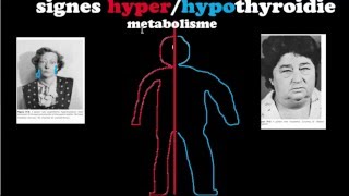 🔴 Dr Astuce  HYPERHYPOTHYROIDIES EXPLIQUÉES CLAIREMENT [upl. by Schreiber]