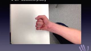 1 minute masterclass EIP adductorplasty for combined high ulnar and median nerve injury [upl. by Pascha286]