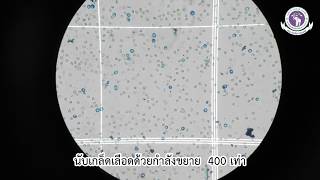 Manual platelet count [upl. by Philips]