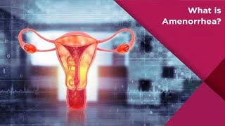 Amenorrhea Causes and symptoms [upl. by Florio680]