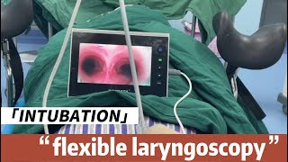 Flexible Laryngoscopy intubation Procedure with BESDATA Disposable Flexible Laryngoscope [upl. by Cantlon]