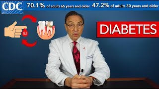 Diabetes amp Gum Disease are Connected [upl. by Arvind276]