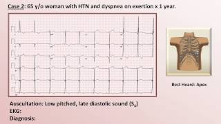 EKG and Heart Murmur Review  Part 1 [upl. by Yardna803]