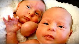 PREEMIE TWINS Cuteness Overload  Dr Paul [upl. by Risser]