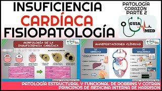 INSUFICIENCIA CARDÍACA FISIOPATOLOGÍA  GuiaMed [upl. by Haniraz]